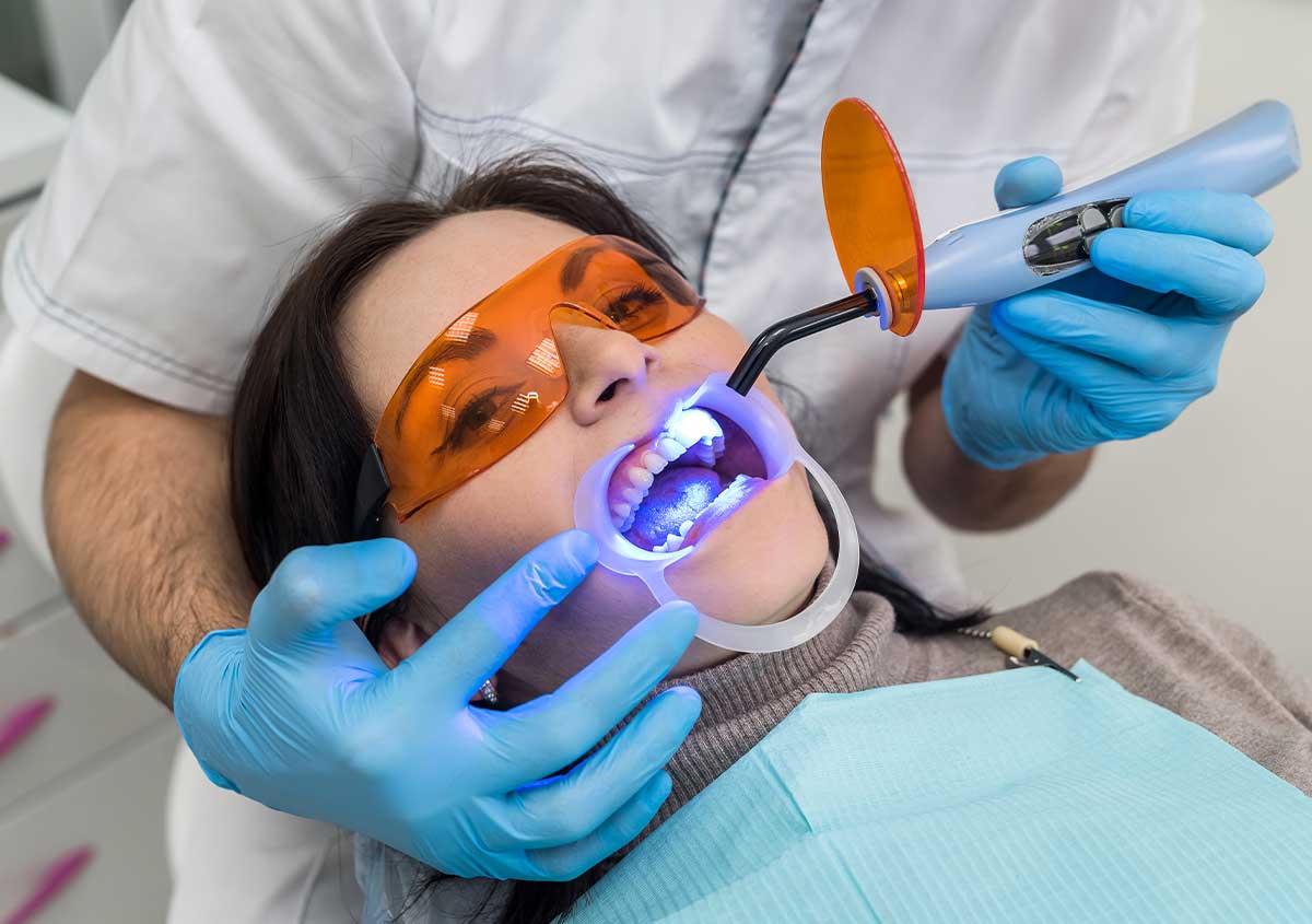 Laser Treatment for Teeth in Oakville ON Area