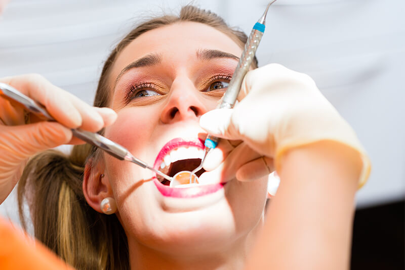 Waterlase Laser Dental Treatment in Oakville ON - Cavity Fillings